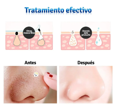 MASCARILLA NEGRA PURIFICANTE CON CARBON