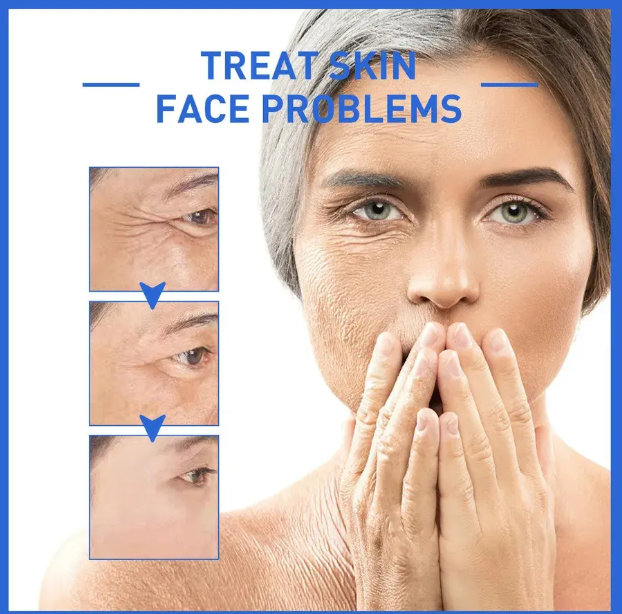 BOTOX STOCK SOLUTION - SÉRUM ANTIARRUGAS